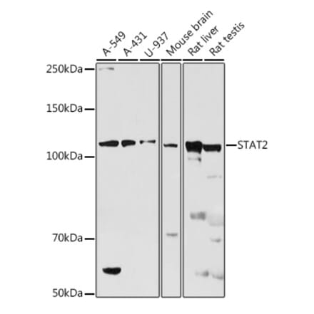 Western Blot - Anti-STAT2 Antibody (A91472) - Antibodies.com