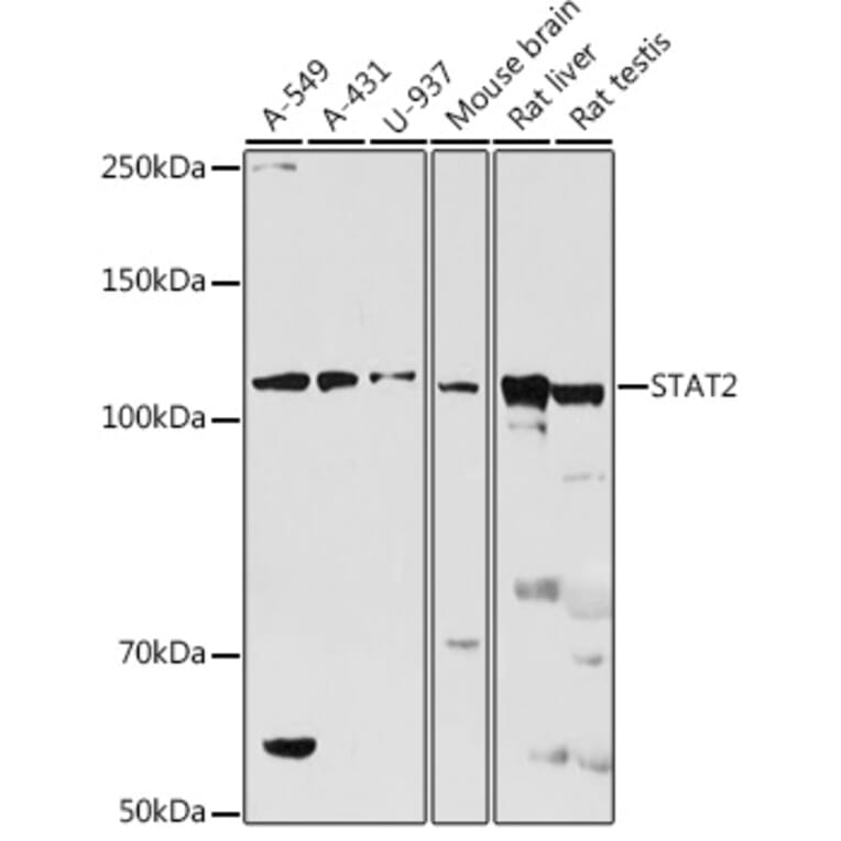 Western Blot - Anti-STAT2 Antibody (A91472) - Antibodies.com