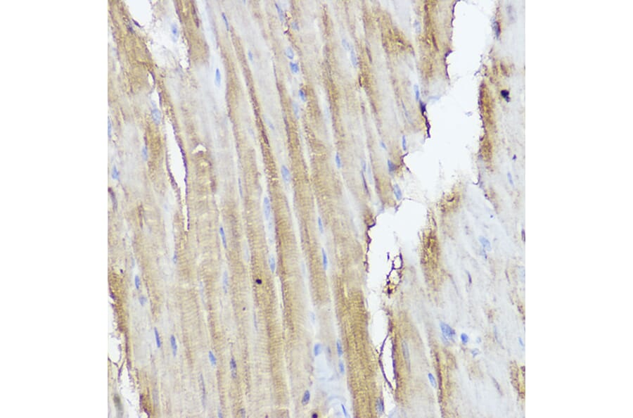 Immunohistochemistry - Anti-STAT2 Antibody (A91472) - Antibodies.com