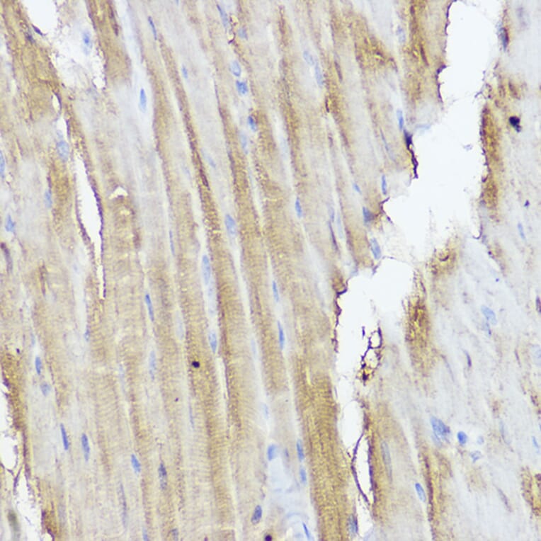 Immunohistochemistry - Anti-STAT2 Antibody (A91472) - Antibodies.com