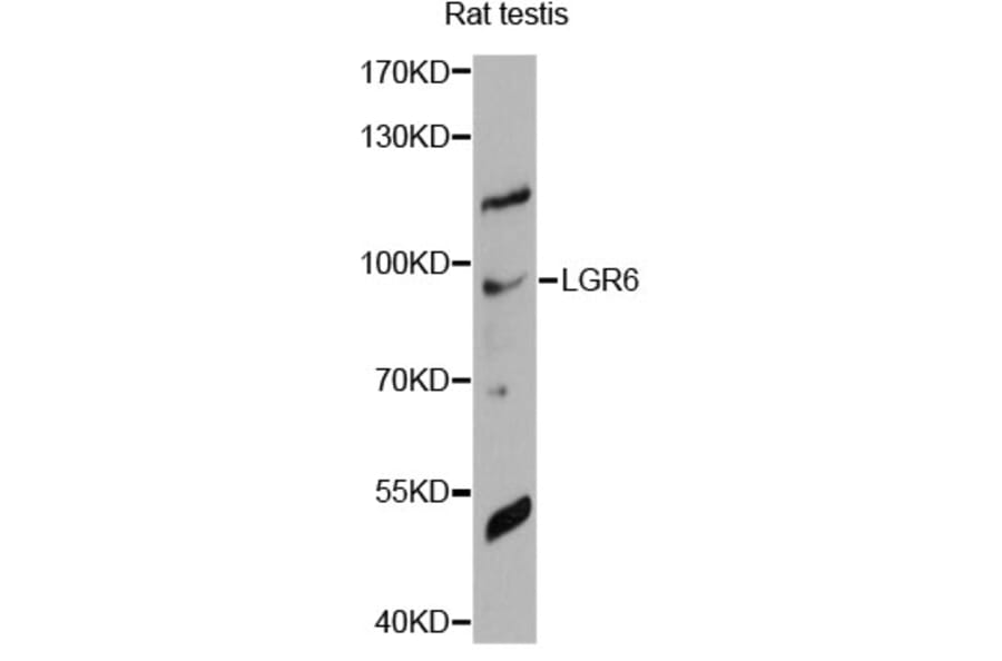 Western Blot - Anti-LGR6 Antibody (A14173) - Antibodies.com