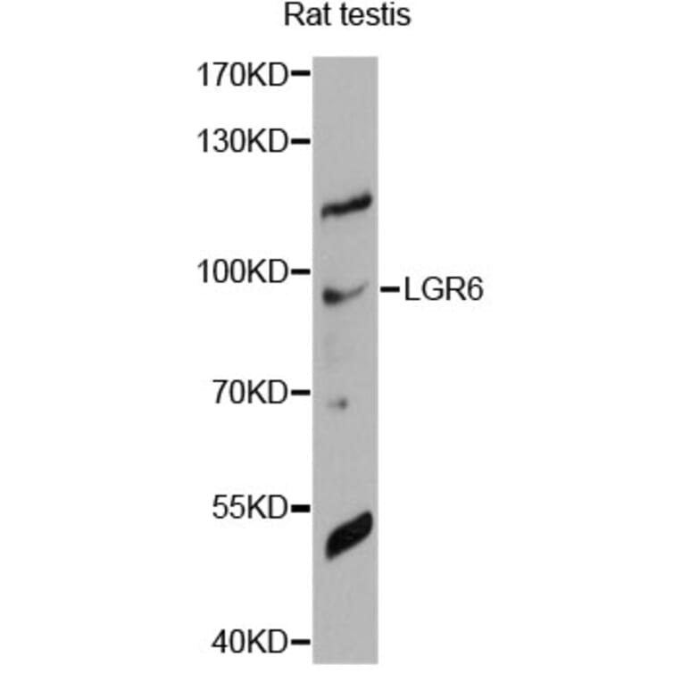 Western Blot - Anti-LGR6 Antibody (A14173) - Antibodies.com
