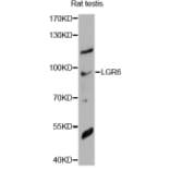 Western Blot - Anti-LGR6 Antibody (A14173) - Antibodies.com
