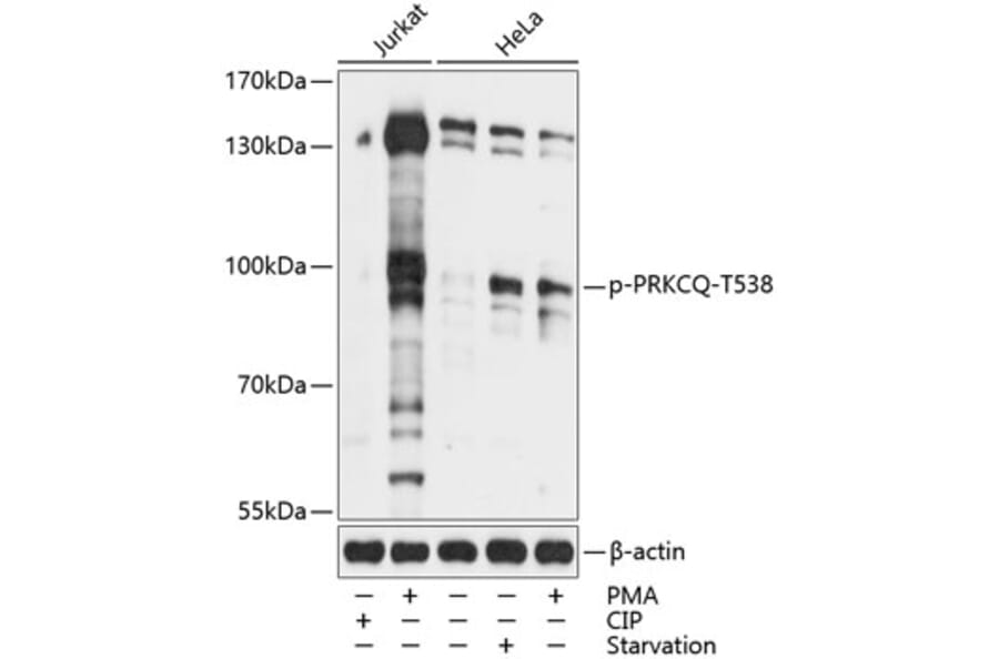 Western Blot - Anti-PKC theta/PRKCQ (phospho Thr538) Antibody (A91474) - Antibodies.com