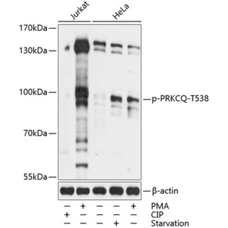 Western Blot - Anti-PKC theta/PRKCQ (phospho Thr538) Antibody (A91474) - Antibodies.com