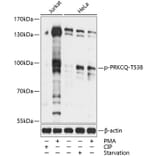 Western Blot - Anti-PKC theta/PRKCQ (phospho Thr538) Antibody (A91474) - Antibodies.com