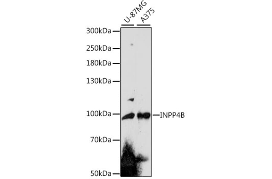 Western Blot - Anti-INPP4B Antibody (A91475) - Antibodies.com