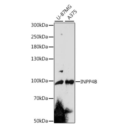 Western Blot - Anti-INPP4B Antibody (A91475) - Antibodies.com