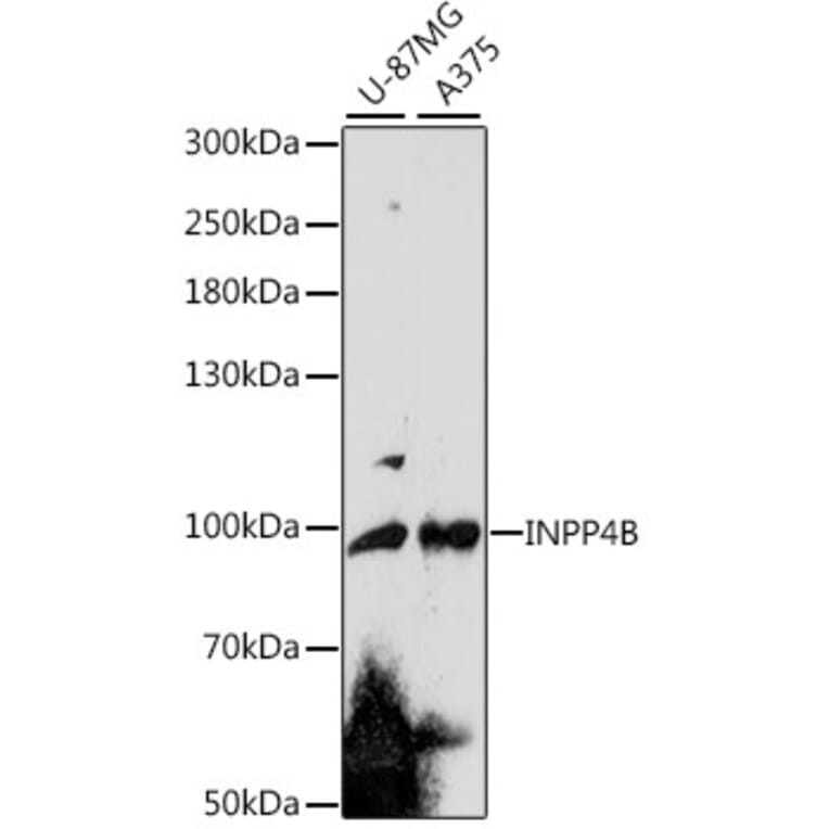 Western Blot - Anti-INPP4B Antibody (A91475) - Antibodies.com