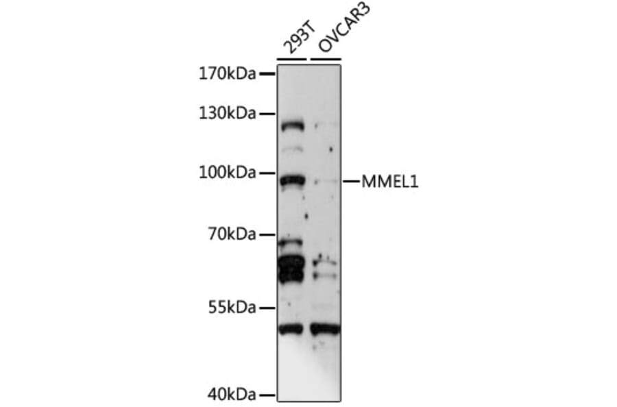 Western Blot - Anti-MMEL1 Antibody (A15188) - Antibodies.com