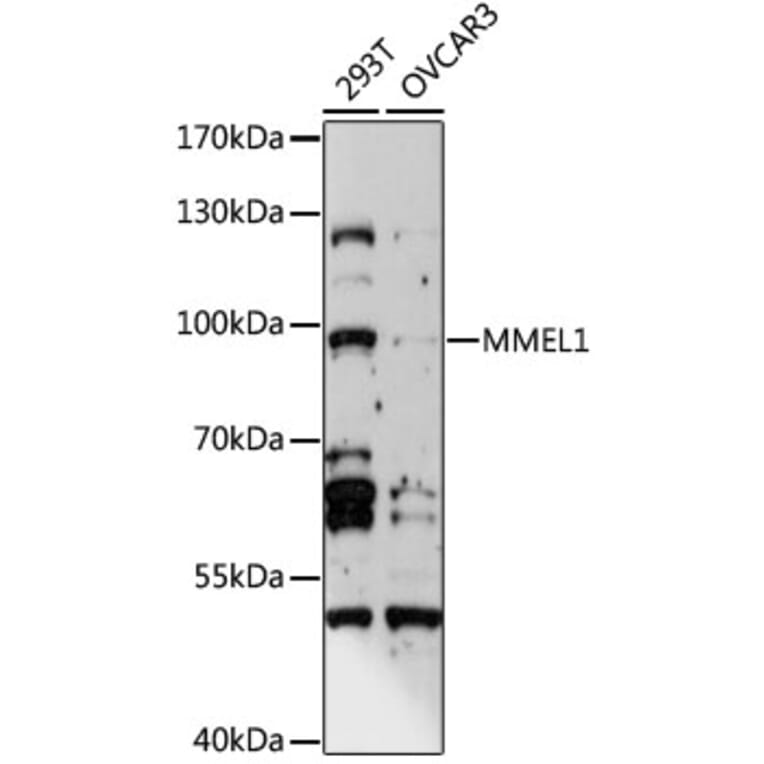 Western Blot - Anti-MMEL1 Antibody (A15188) - Antibodies.com