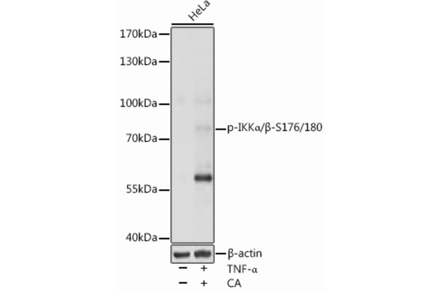 Western Blot - Anti-IKK alpha + IKK beta (phospho Ser176 + Ser180) Antibody (A91478) - Antibodies.com