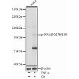 Western Blot - Anti-IKK alpha + IKK beta (phospho Ser176 + Ser180) Antibody (A91478) - Antibodies.com