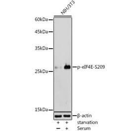 Western Blot - Anti-eIF4E (phospho Ser209) Antibody (A91480) - Antibodies.com