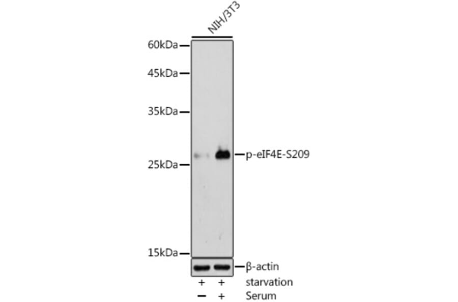 Western Blot - Anti-eIF4E (phospho Ser209) Antibody (A91480) - Antibodies.com