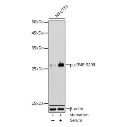 Western Blot - Anti-eIF4E (phospho Ser209) Antibody (A91480) - Antibodies.com