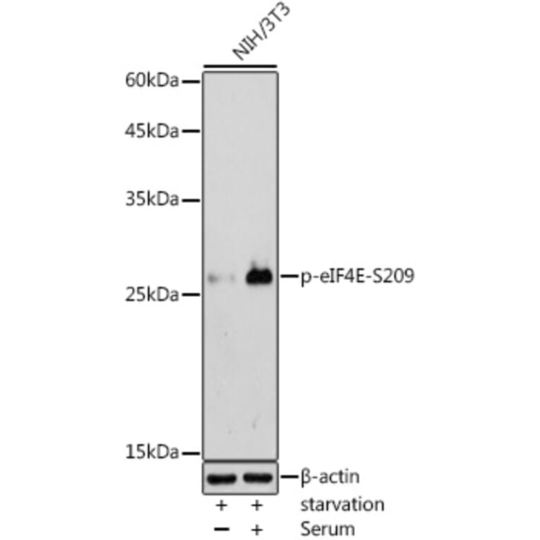 Western Blot - Anti-eIF4E (phospho Ser209) Antibody (A91480) - Antibodies.com