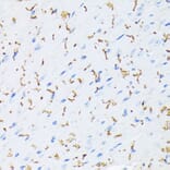 Immunohistochemistry - Anti-Connexin 43/GJA1 (phospho Ser368) Antibody (A91483) - Antibodies.com