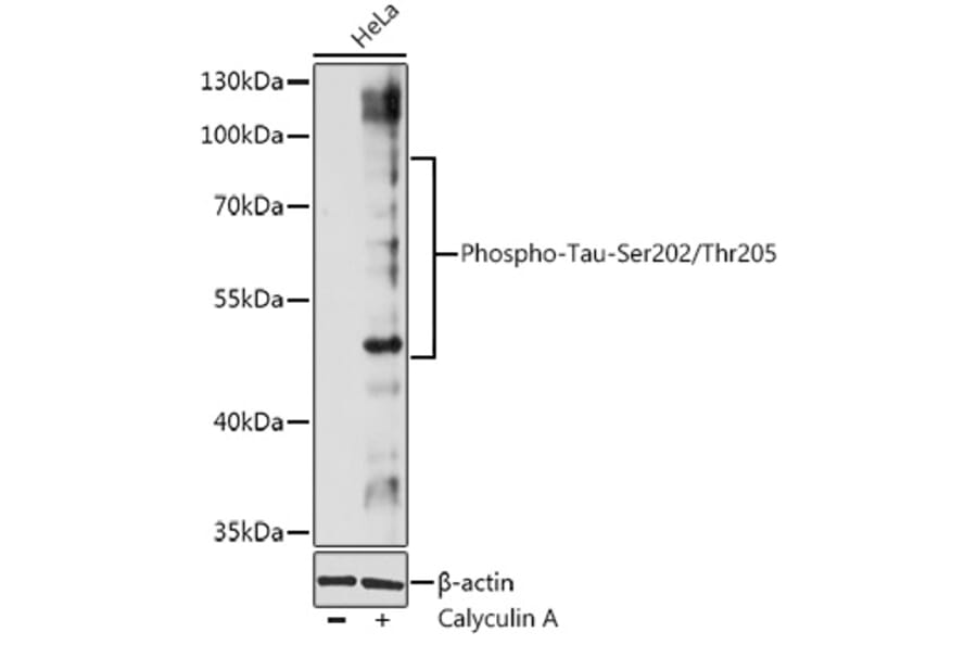 Western Blot - Anti-Tau (phospho Ser202 + Thr205) Antibody (A91486) - Antibodies.com