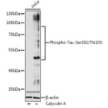 Western Blot - Anti-Tau (phospho Ser202 + Thr205) Antibody (A91486) - Antibodies.com