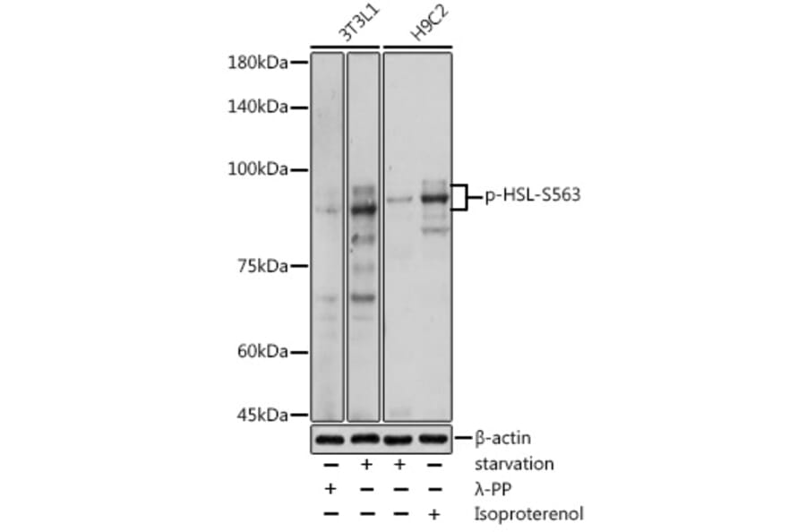 Western Blot - Anti-Hormone sensitive lipase/HSL (phospho Ser563) Antibody (A91487) - Antibodies.com