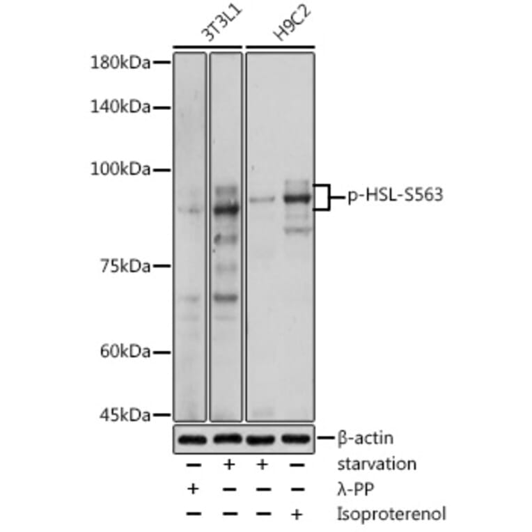 Western Blot - Anti-Hormone sensitive lipase/HSL (phospho Ser563) Antibody (A91487) - Antibodies.com