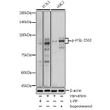 Western Blot - Anti-Hormone sensitive lipase/HSL (phospho Ser563) Antibody (A91487) - Antibodies.com