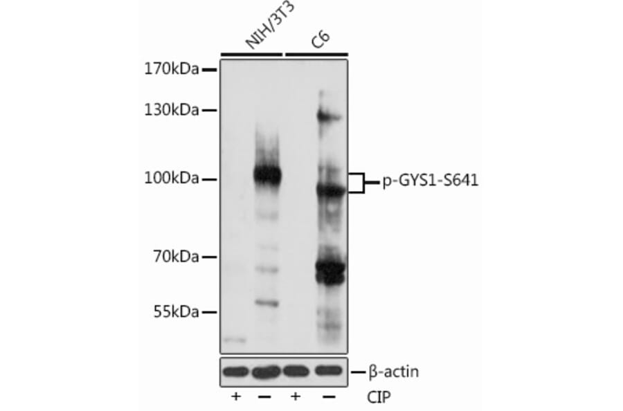 Western Blot - Anti-Glycogen synthase 1/GYS1 (phospho Ser641) Antibody (A91490) - Antibodies.com