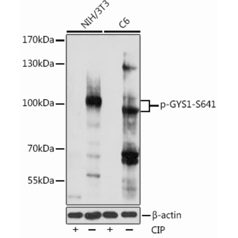 Western Blot - Anti-Glycogen synthase 1/GYS1 (phospho Ser641) Antibody (A91490) - Antibodies.com
