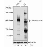 Western Blot - Anti-Glycogen synthase 1/GYS1 (phospho Ser641) Antibody (A91490) - Antibodies.com