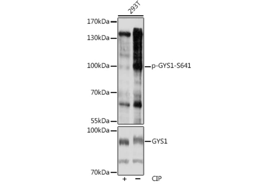 Western Blot - Anti-Glycogen synthase 1/GYS1 (phospho Ser641) Antibody (A91490) - Antibodies.com