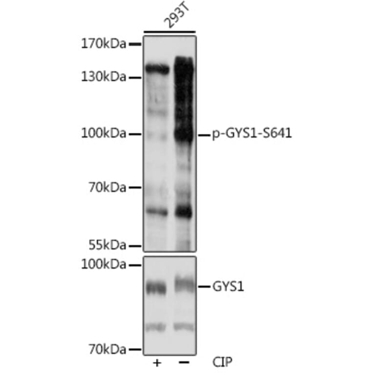Western Blot - Anti-Glycogen synthase 1/GYS1 (phospho Ser641) Antibody (A91490) - Antibodies.com