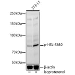 Western Blot - Anti-Hormone sensitive lipase/HSL (phospho Ser660) Antibody (A91491) - Antibodies.com