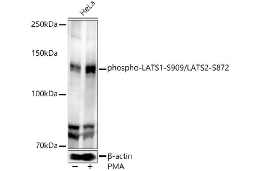 Western Blot - Anti-LATS1/WARTS (phospho Ser909) + LATS2 (phospho Ser872) Antibody (A91496) - Antibodies.com