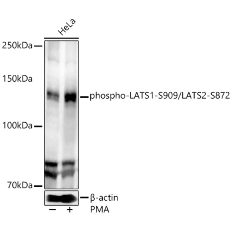 Western Blot - Anti-LATS1/WARTS (phospho Ser909) + LATS2 (phospho Ser872) Antibody (A91496) - Antibodies.com