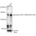 Western Blot - Anti-LATS1/WARTS (phospho Ser909) + LATS2 (phospho Ser872) Antibody (A91496) - Antibodies.com