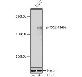 Western Blot - Anti-Tuberin (phospho Thr1462) Antibody (A91500) - Antibodies.com