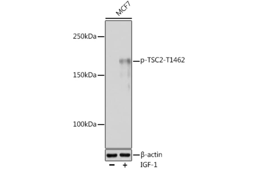 Western Blot - Anti-Tuberin (phospho Thr1462) Antibody (A91500) - Antibodies.com