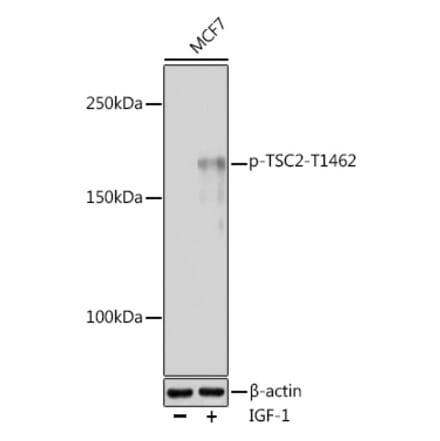 Western Blot - Anti-Tuberin (phospho Thr1462) Antibody (A91500) - Antibodies.com