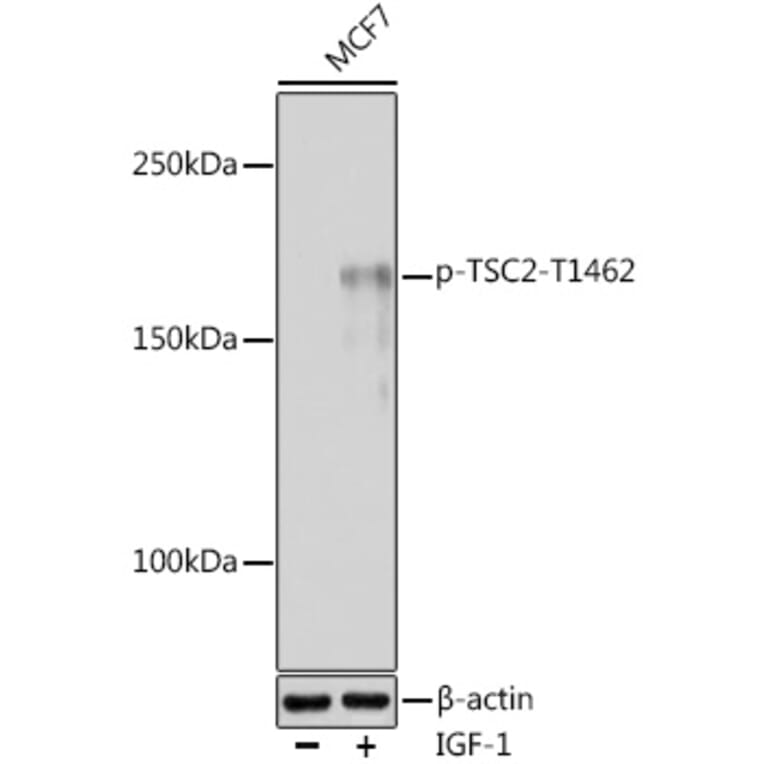 Western Blot - Anti-Tuberin (phospho Thr1462) Antibody (A91500) - Antibodies.com