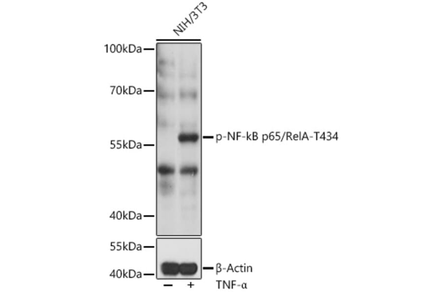 Western Blot - Anti-NF-kB p65 (phospho Thr434) Antibody (A91503) - Antibodies.com