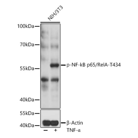 Western Blot - Anti-NF-kB p65 (phospho Thr434) Antibody (A91503) - Antibodies.com
