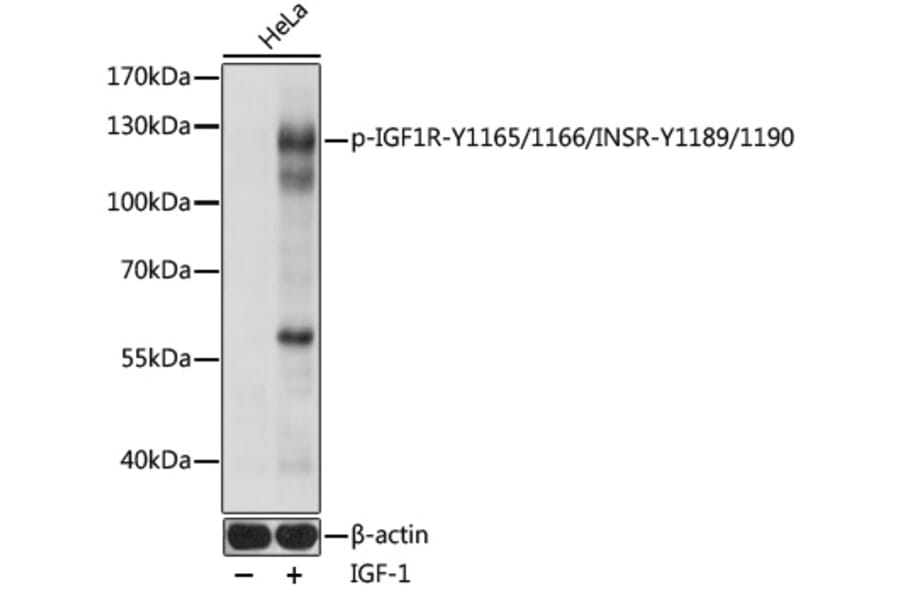 Western Blot - Anti-Insulin Receptor (phospho Tyr1165 + Tyr1166) + IGF1 Receptor (phospho Tyr1189 + Tyr1190) Antibody (A91506) - Antibodies.com