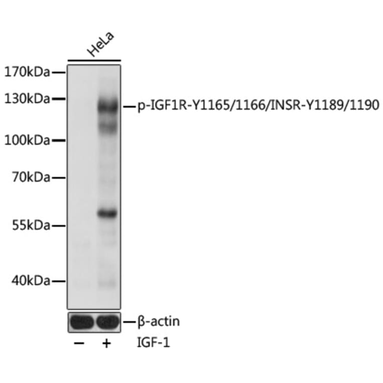 Western Blot - Anti-Insulin Receptor (phospho Tyr1165 + Tyr1166) + IGF1 Receptor (phospho Tyr1189 + Tyr1190) Antibody (A91506) - Antibodies.com