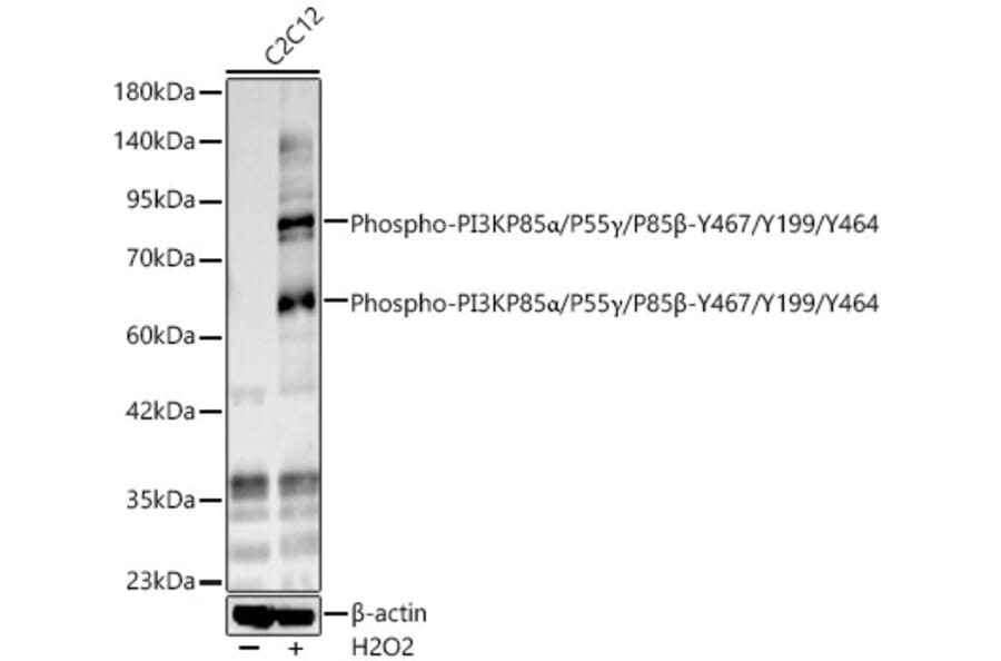 Western Blot - Anti-PI 3 Kinase p85 alpha (Phospho Y467/Y199/Y464) Antibody (A91507) - Antibodies.com