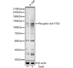 Western Blot - Anti-Axl (phospho Tyr702) Antibody (A91508) - Antibodies.com