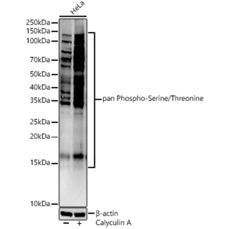 Western Blot - Anti-pan phospho Ser + Thr Antibody (A91509) - Antibodies.com