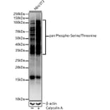 Western Blot - Anti-pan phospho Ser + Thr Antibody (A91509) - Antibodies.com