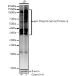 Western Blot - Anti-pan phospho Ser + Thr Antibody (A91509) - Antibodies.com
