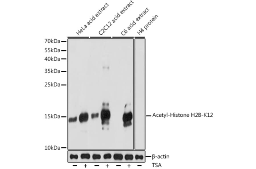 Western Blot - Anti-Histone H2B (acetyl Lys12) Antibody (A91510) - Antibodies.com